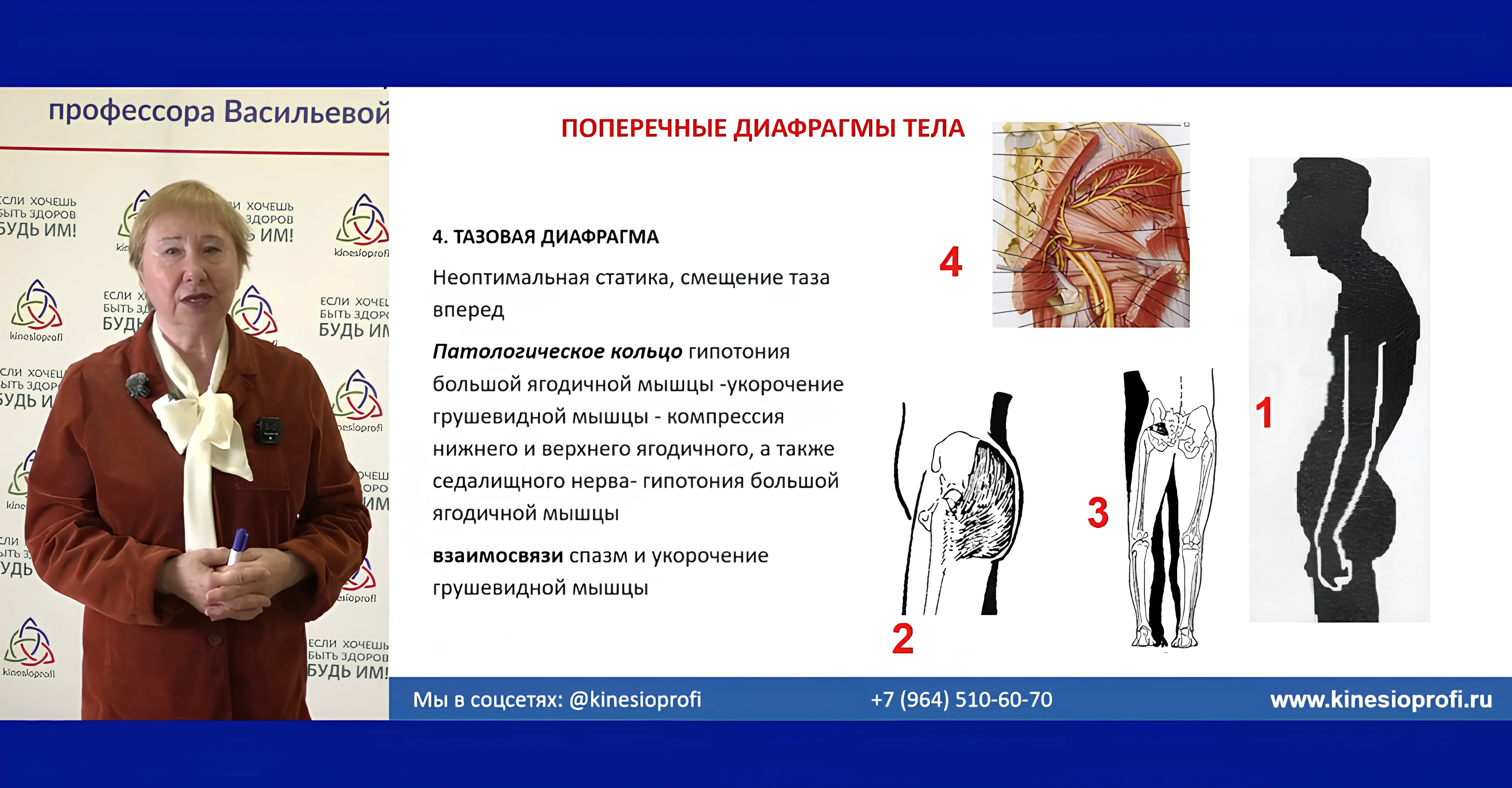 Вебинар Академии медицинской кинезиологии